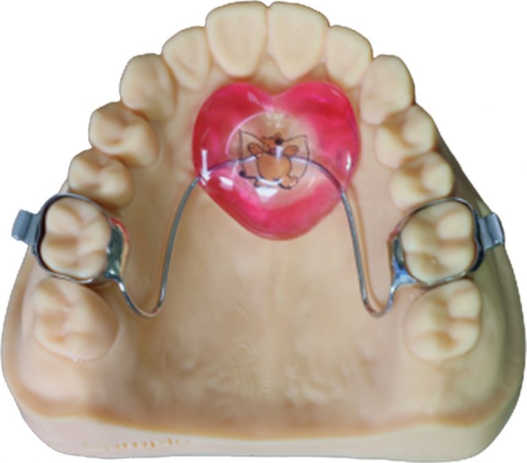 Orthodontics Products Bright Dental Lab