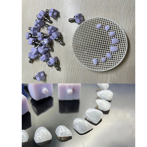 NEW CAD VENEERS - Bright Dental Lab