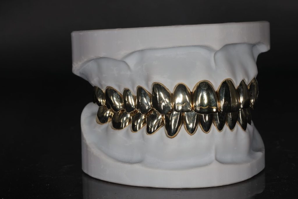 Full Gold Crown FGC