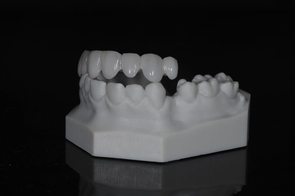 Snap-On Smile milled appliance