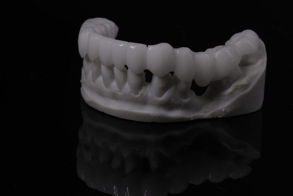 Snap-On Smile milled appliance